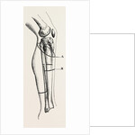 Disarticulation isarticulation by Anonymous