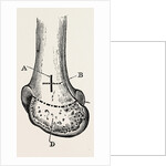 Macewen by Anonymous