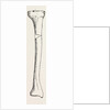 Diagram representing a curved tibia, with a wedge removed by Anonymous