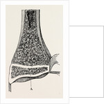 Radio-car lower end of the radius by Anonymous