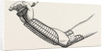 Ollieris wire splint for excision of the wrist by Anonymous