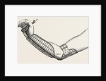 Ollieris wire splint for excision of the wrist by Anonymous