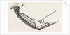 Ollieris wire splint for excision of the wrist by Anonymous