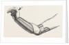 Ollieris wire splint for excision of the wrist by Anonymous