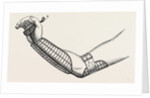 Ollieris wire splint for excision of the wrist by Anonymous