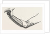 Ollieris wire splint for excision of the wrist by Anonymous