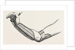 Ollieris wire splint for excision of the wrist by Anonymous