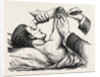 Excision of the elbow, the clearing of the humerus by Anonymous