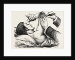 Excision of the elbow, the clearing of the humerus by Anonymous