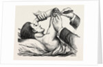 Excision of the elbow, the clearing of the humerus by Anonymous