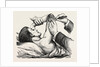 Excision of the elbow, the clearing of the humerus by Anonymous