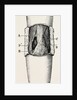 Right elbow after excision by Anonymous