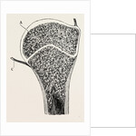 Upper end of the humerus by Anonymous