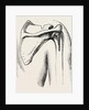 Excision of shoulder by Anonymous