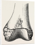 Epiphyses of the femur by Anonymous