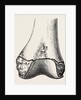 Epiphyses of the femur by Anonymous