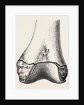 Epiphyses of the femur by Anonymous