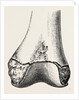 Epiphyses of the femur by Anonymous