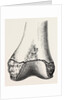 Epiphyses of the femur by Anonymous