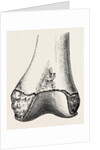 Epiphyses of the femur by Anonymous