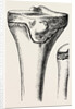 Epiphyses of the femur by Anonymous