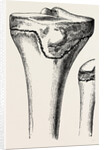Epiphyses of the femur by Anonymous