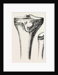 Epiphyses of the femur by Anonymous