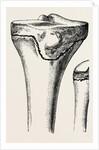 Epiphyses of the femur by Anonymous