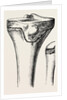 Epiphyses of the femur by Anonymous