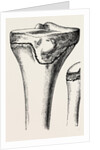 Epiphyses of the femur by Anonymous