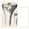 Epiphyses of the femur by Anonymous