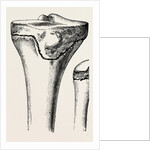 Epiphyses of the femur by Anonymous