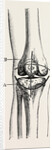 Excision of the operation the limb by Anonymous