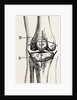 Excision of the operation the limb by Anonymous