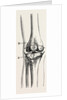 Excision of the operation the limb by Anonymous