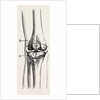 Excision of the operation the limb by Anonymous