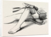 Excision of the knee, the sawing of the lower end by Anonymous