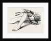 Excision of the knee, the sawing of the lower end by Anonymous