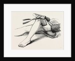 Excision of the knee, the sawing of the lower end by Anonymous