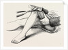 Excision of the knee, the sawing of the lower end by Anonymous