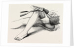 Excision of the knee, the sawing of the lower end by Anonymous