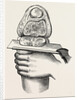 Excision of the knee by Anonymous