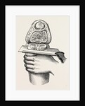 Excision of the knee by Anonymous