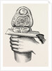 Excision of the knee by Anonymous
