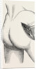 Excision of the hip by an external incision by Anonymous