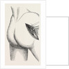Excision of the hip by an external incision by Anonymous