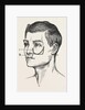 Excision of the tipper jaw by Anonymous
