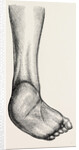 Incurved form of the foot, the planzar by Anonymous