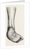 Incurved form of the foot, the planzar by Anonymous