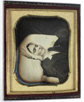 Post-mortem of a woman by Anonymous
